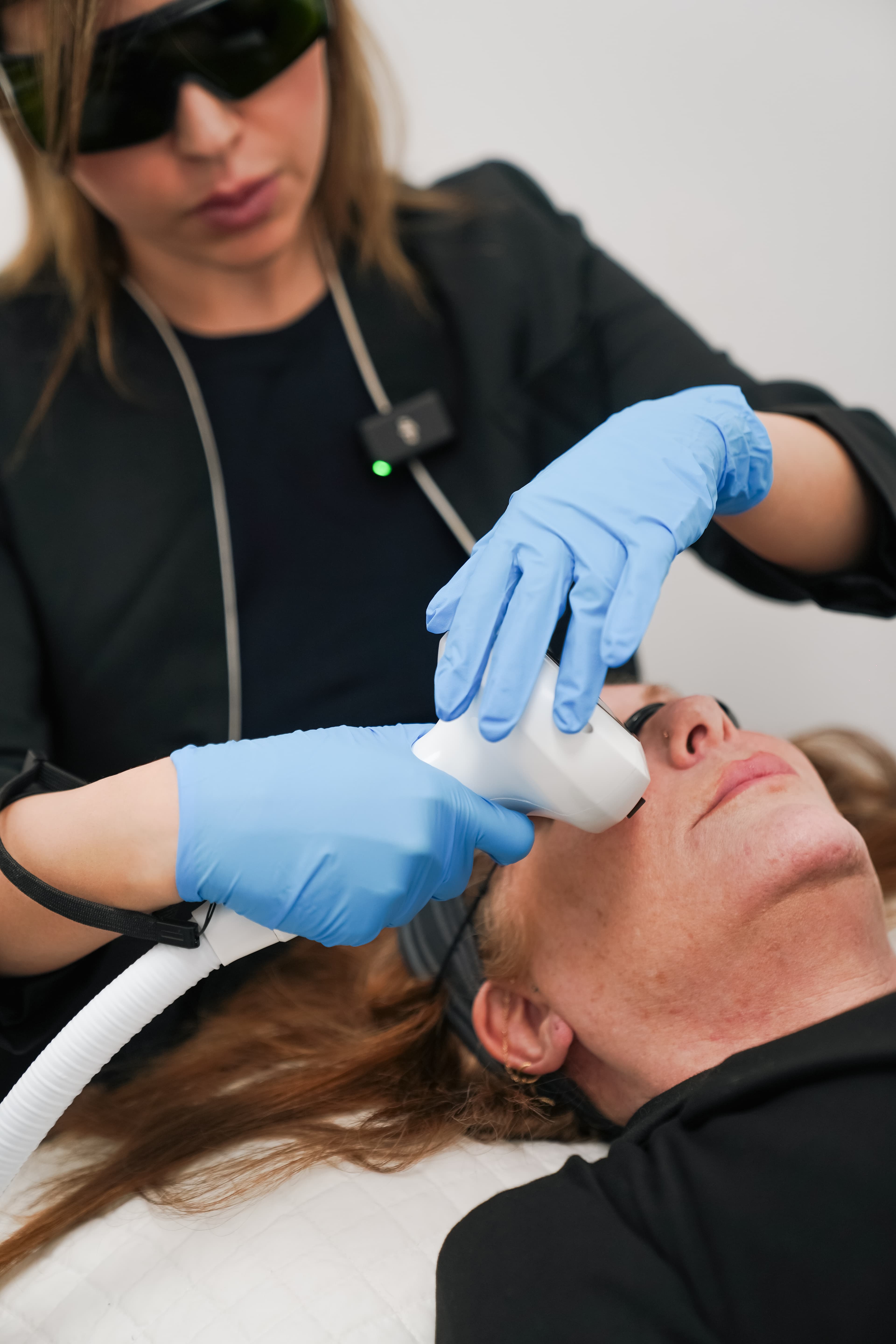 Laser skin treatment