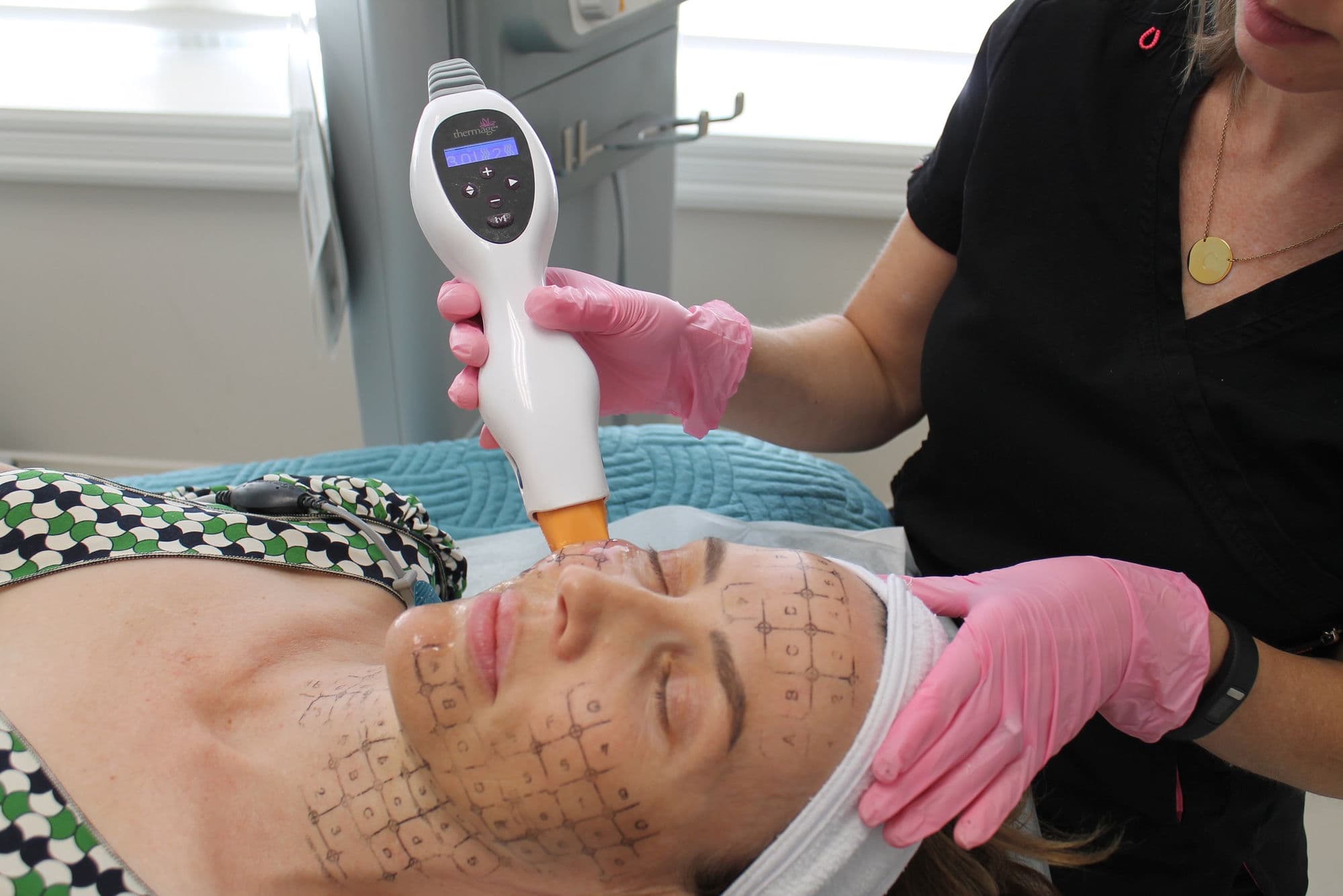Thermage radiofrequency skin tightening